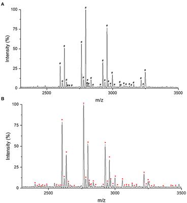A Preliminary Study on Change of Serum Immunoglobulin G Glycosylation in Patients With Migraine